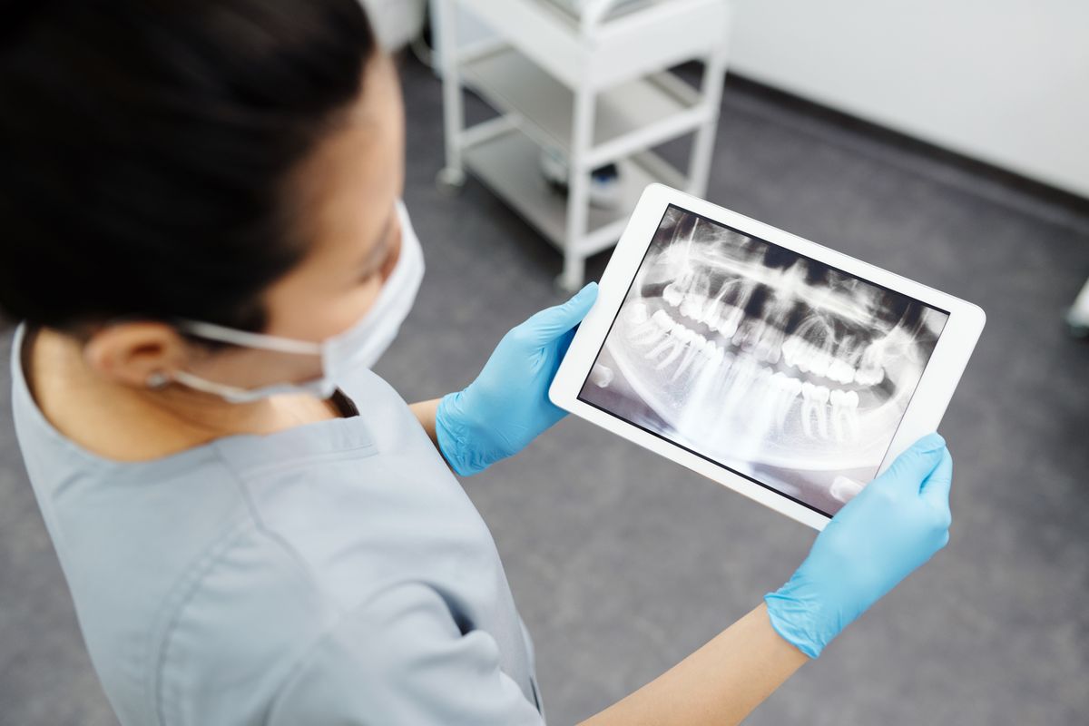 Radiologia dentale
